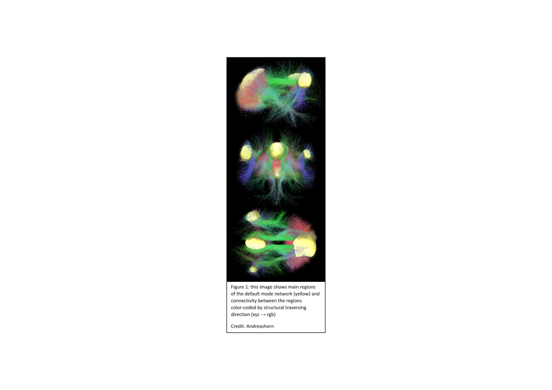 Default Mode Network
